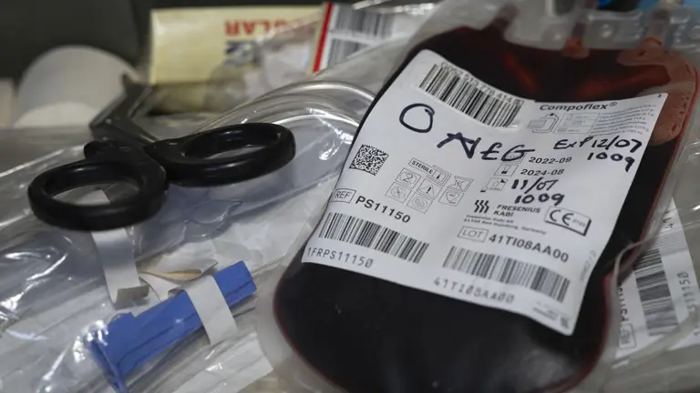 A bag of O negative blood labeled with collection details is placed on a cluttered medical tray. Nearby are medical scissors and a small plastic device.